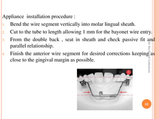 82
Appliance installation procedure :
1. Bend the wire segment vertically into molar lingual sheath.
2. Cut to the tube to length allowing 1 mm for the bayonet wire entry.
3. From the double back , seat in sheath and check passive fit and
parallel relationship.
4. Finish the anterior wire segment for desired corrections keeping as
close to the gingival margin as possible.
DrRavikanthLakkakula
 