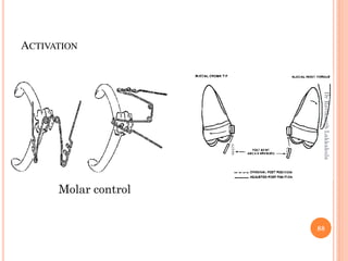 ACTIVATION
Molar control
88
DrRavikanthLakkakula
 