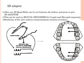 DrRavikanthLakkakula
After use 3D Quad Helix can be cut between the helices and posts to give
3D ADAPTOR
This can be used as BUCCAL EXPANDER for Cuspid amd Bicuspid expansion
Resiliency of the wire reduces countermoment reaction of molars.
3D adaptor
89
 