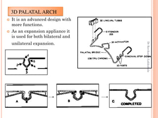 3D PALATAL ARCH
 It is an advanced design with
more functions.
 As an expansion appliance it
is used for both bilateral and
unilateral expansion.
90
DrRavikanthLakkakula
 