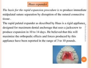 32
The basis for the rapid expansion procedure is to produce immediate
midpalatal suture separation by disruption of the s...