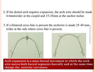 93
2. If the dental arch requires expansion, the arch wire should be made
4-6mmwider at the cuspid and 15-25mm at the anch...
