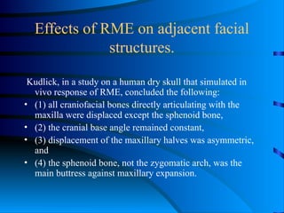 Comprehensive Overview of Expansion Techniques in Orthodontics: History ...