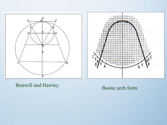 Arch form | PPTX | Dental Health | Diseases and Conditions