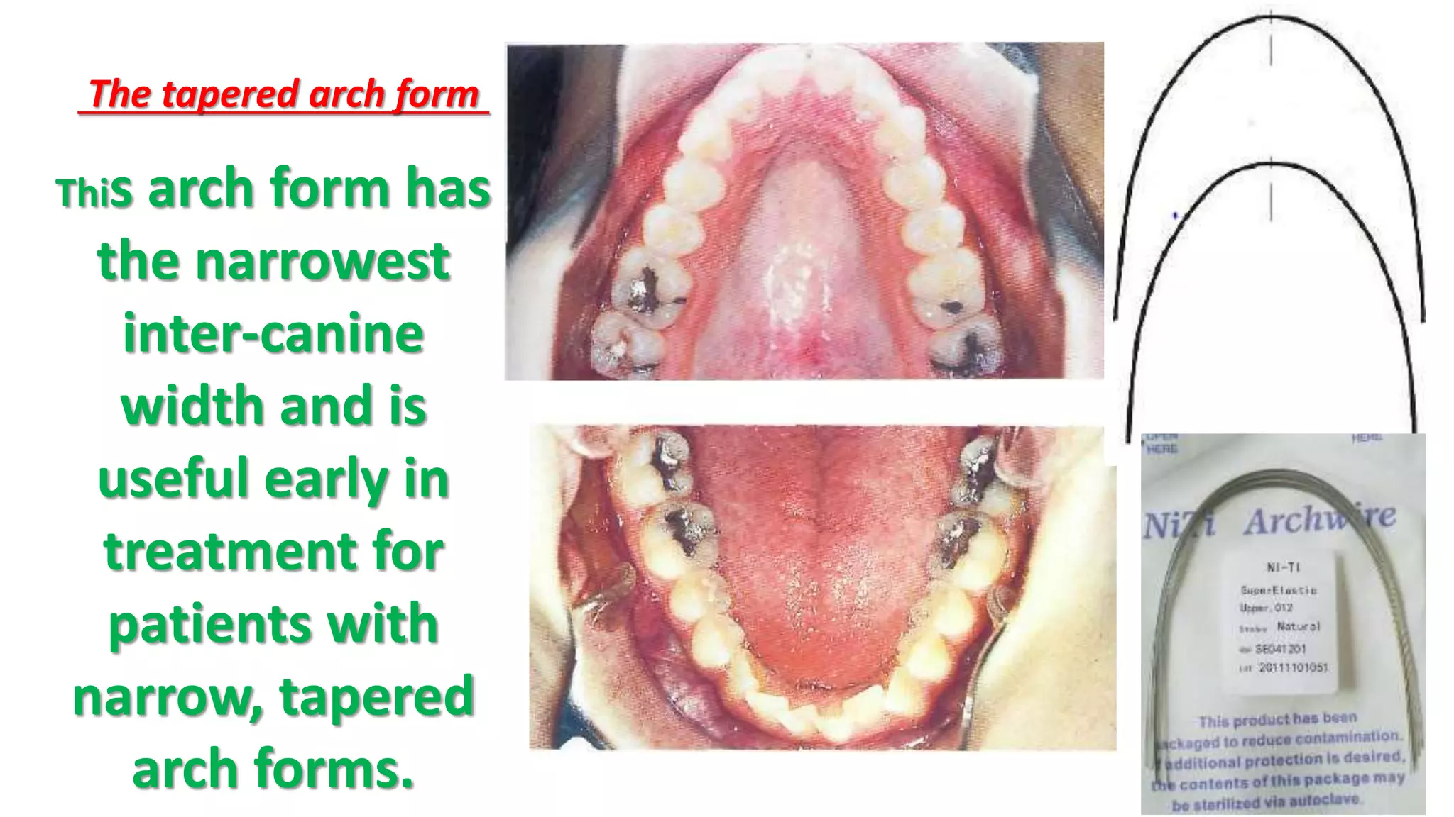 orthodontic arch form | PPTX