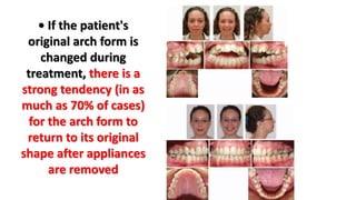 orthodontic arch form | PPTX