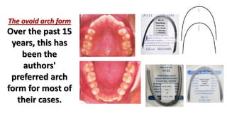 orthodontic arch form | PPTX