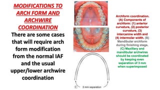 orthodontic arch form | PPTX