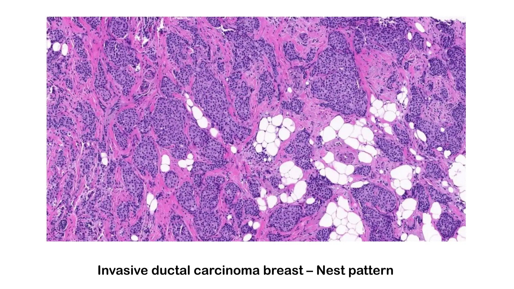 ARCHITECTURAL PATTERNS IN HISTOPATHOLOGY pdf- [Autosaved].pdf