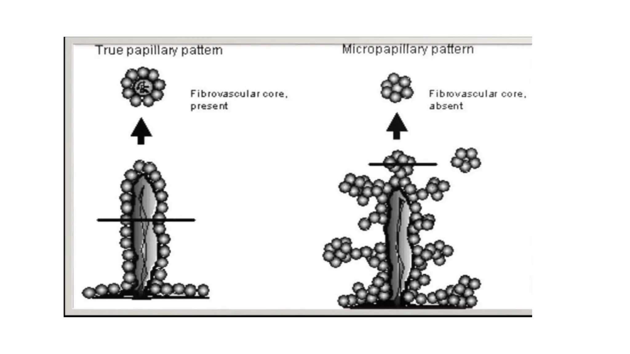 ARCHITECTURAL PATTERNS IN HISTOPATHOLOGY pdf- [Autosaved].pdf