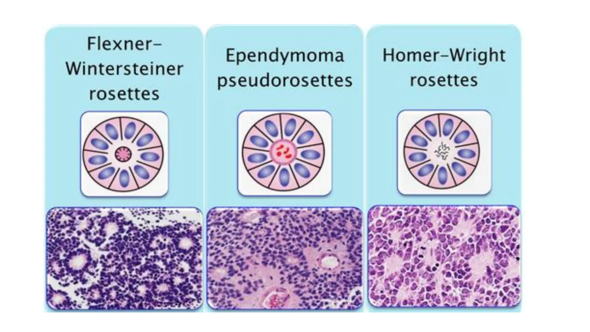 ARCHITECTURAL PATTERNS IN HISTOPATHOLOGY pdf- [Autosaved].pdf