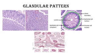 GLANDULAR PATTERN
 