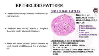 Epithelioid pattern
 Epithelioid morphology refers to resemblance to
epithelial cells.
 Epithelioid cells usually feature a polygonal
shape and exhibit abundant cytoplasm.
 These can show variable growth patterns as
solid, nesting, sheet-like, cord-like, or glandular-
like.
 
