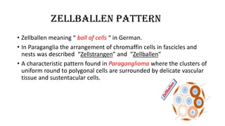 ZELLBALLEN PATTERN
• Zellballen meaning “ ball of cells “ in German.
• In Paraganglia the arrangement of chromaffin cells in fascicles and
nests was described “Zellstrangen” and “Zellballen”
• A characteristic pattern found in Paraganglioma where the clusters of
uniform round to polygonal cells are surrounded by delicate vascular
tissue and sustentacular cells.
 