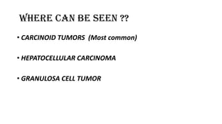 WHERE CAN BE SEEN ??
• CARCINOID TUMORS (Most common)
• HEPATOCELLULAR CARCINOMA
• GRANULOSA CELL TUMOR
 