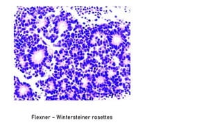 Flexner – Wintersteiner rosettes
 