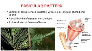 FASICULAR PATTERN
• Bundles of cells arrenged in parallel with cellular long axis aligned end
to end
• A small bundle of nerve or muscle fibers
• A close cluster of flowers of leaves
 