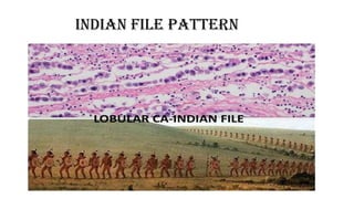 INDIAN FILE PATTERN
 