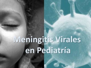 Meningitis Virales
en Pediatría
 