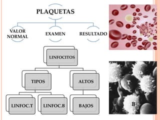 PLAQUETAS
VALOR
NORMAL
EXAMEN RESULTADO
LINFOCITOS
TIPOS
LINFOC.T LINFOC.B
ALTOS
BAJOS
 