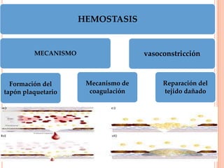 HEMOSTASIS
MECANISMO
Formación del
tapón plaquetario
Mecanismo de
coagulación
vasoconstricción
Reparación del
tejido dañado
 