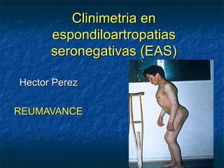Clinimetria en
      espondiloartropatias
      seronegativas (EAS)

Hector Perez

REUMAVANCE
 