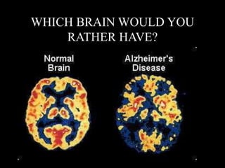 WHICH BRAIN WOULD YOU
RATHER HAVE?
 