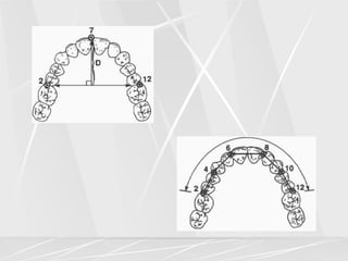Arch lengthening and expansion.ppt