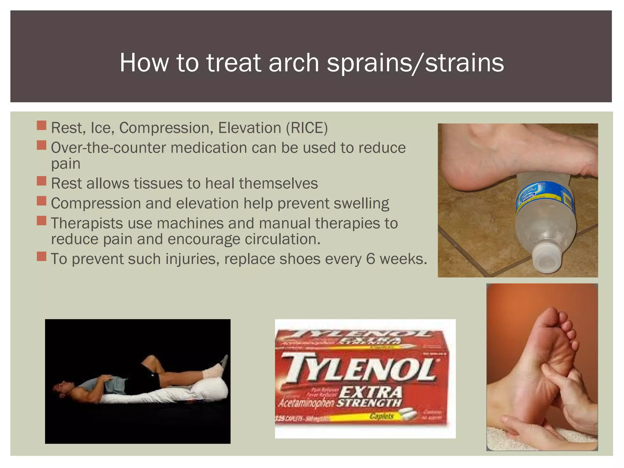 Arch Injuries Arch sprains | PPT