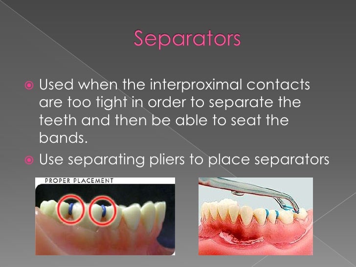 Arch wires, elastic ties and separators