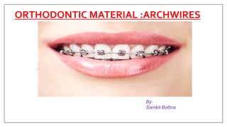 ORTHODONTIC MATERIAL :ARCHWIRES
By
Samkit Bothra
 