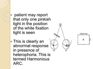  patient may report
that only one pinkish
light in the position
of the white fixation
light is seen
 This is clearly an
abnormal response
in presence of
heterophoria. This is
termed Harmonious
ARC.
 