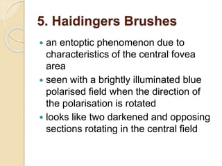 5. Haidingers Brushes
 an entoptic phenomenon due to
characteristics of the central fovea
area
 seen with a brightly illuminated blue
polarised field when the direction of
the polarisation is rotated
 looks like two darkened and opposing
sections rotating in the central field
 