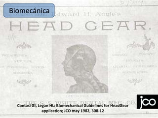 Biomecánica

Contasi GI, Legan HL: Biomechanical Guidelines for HeadGear
application; JCO may 1982, 308-12

33

 