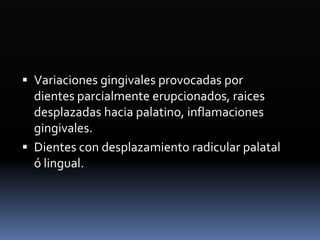  Variaciones gingivales provocadas por
dientes parcialmente erupcionados, raices
desplazadas hacia palatino, inflamaciones
gingivales.
 Dientes con desplazamiento radicular palatal
ó lingual.
 