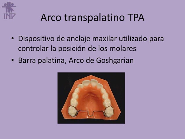 Arco Transpalatino PPTX arco-transpalatino-pptx