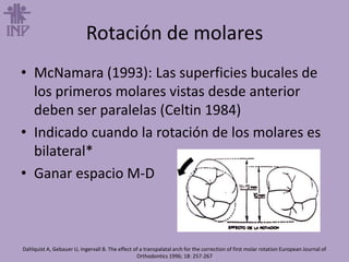 Rotación de molares
• McNamara (1993): Las superficies bucales de
los primeros molares vistas desde anterior
deben ser paralelas (Celtin 1984)
• Indicado cuando la rotación de los molares es
bilateral*
• Ganar espacio M-D
Dahlquist A, Gebauer U, Ingervall B. The effect of a transpalatal arch for the correction of first molar rotation European Journal of
Orthodontics 1996; 18: 257-267
 