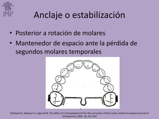 Anclaje o estabilización
• Posterior a rotación de molares
• Mantenedor de espacio ante la pérdida de
segundos molares temporales
Dahlquist A, Gebauer U, Ingervall B. The effect of a transpalatal arch for the correction of first molar rotation European Journal of
Orthodontics 1996; 18: 257-267
 