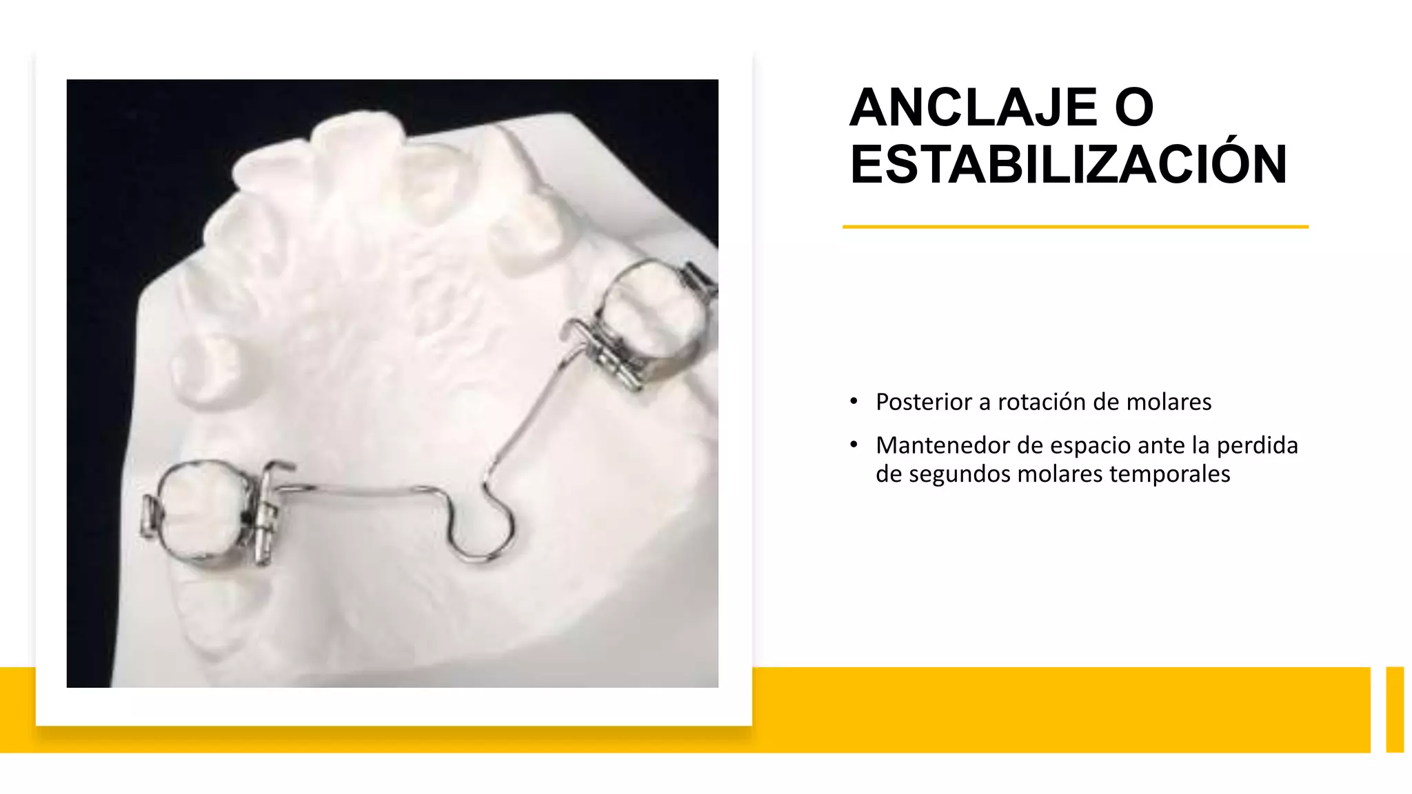 Arco Transpalatino Y Arco Lingual PPTX arco-transpalatino-y-arco-lingual-pptx