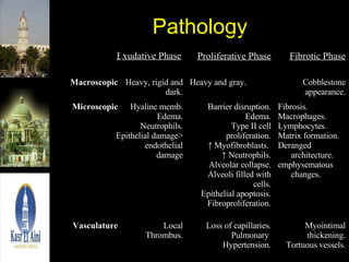 Pathology Myointimal thickening. Tortuous vessels. Loss of capillaries. Pulmonary  Hypertension. Local Thrombus. Vasculature Fibrosis. Macrophages. Lymphocytes. Matrix formation. Deranged architecture. emphysematous changes. Barrier disruption. Edema. Type II cell proliferation. ↑  Myofibroblasts.  ↑  Neutrophils. Alveolar collapse. Alveoli filled with cells. Epithelial apoptosis. Fibroproliferation. Hyaline memb. Edema. Neutrophils. Epithelial damage> endothelial damage Microscopic Cobblestone appearance. Heavy and gray. Heavy, rigid and dark. Macroscopic Fibrotic Phase Proliferative Phase Exudative Phase 