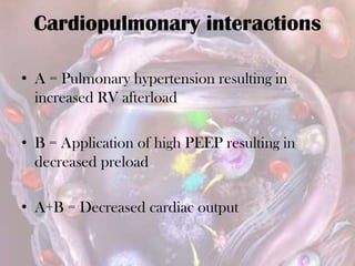 Cardiopulmonary interactions
• A = Pulmonary hypertension resulting in
increased RV afterload
• B = Application of high PEEP resulting in
decreased preload
• A+B = Decreased cardiac output
 