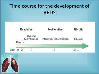 Time course for the development of
ARDS
 