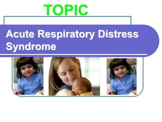 Acute Respiratory Distress Syndrome | PPTX