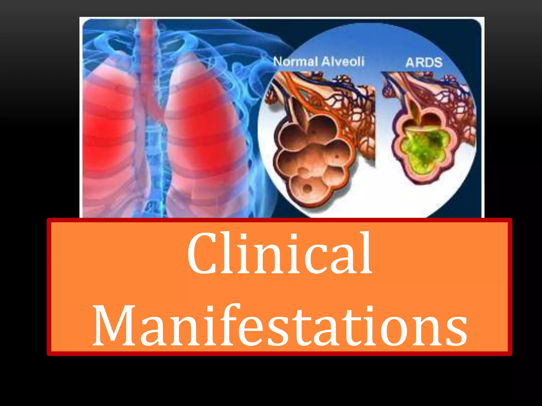 Respiratory Distress? Don'T Wait – Check These Key Indicators - fg78vto