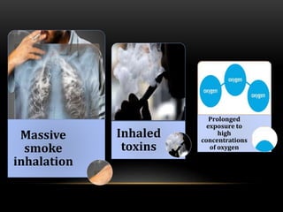 Acute respiratory distress syndrome | PPTX