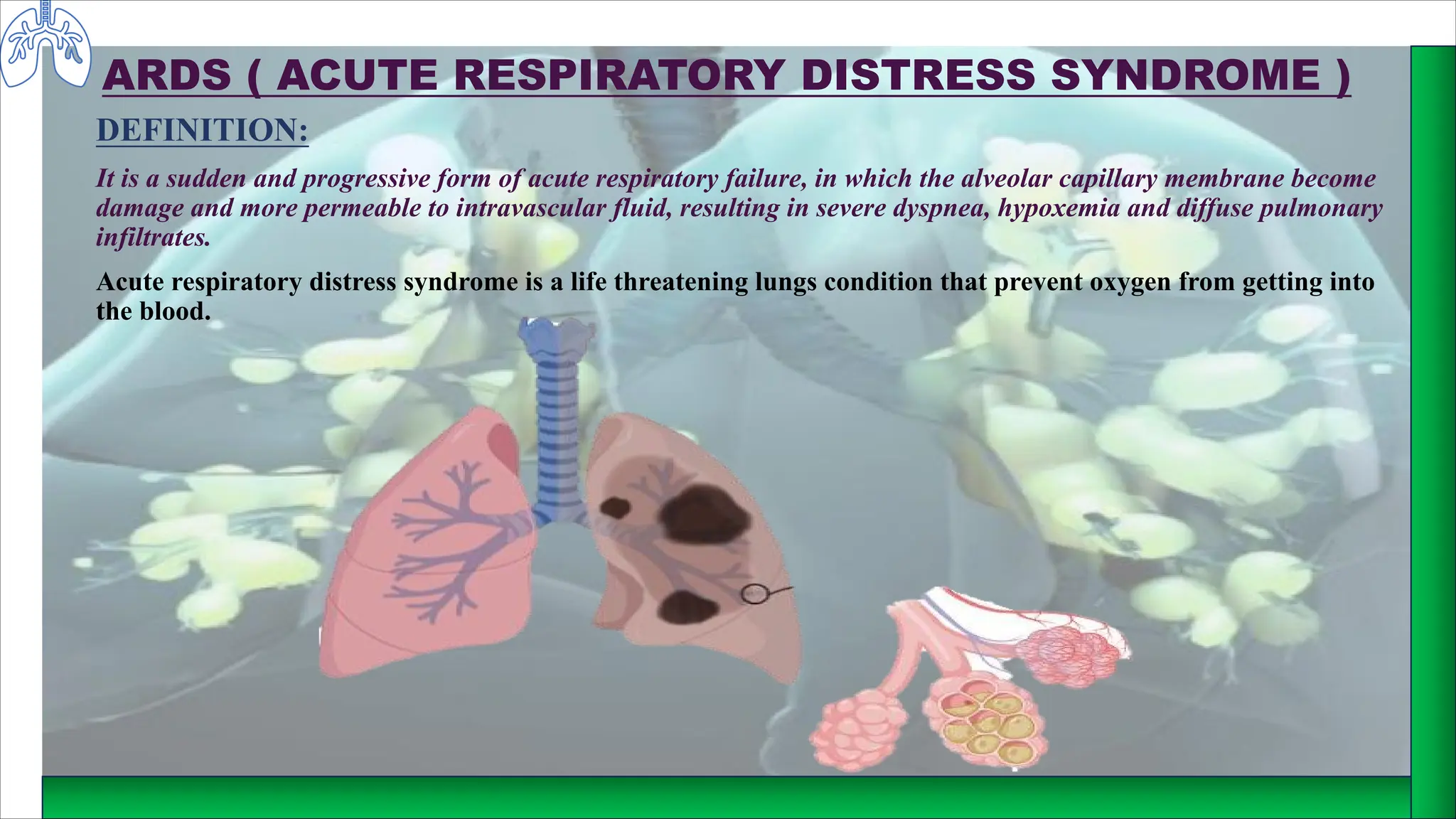 ARDS ( ACUTE RESPIRATORY DISTRESS SYNDROME )
DEFINITION:
It is a sudden and progressive form of acute respiratory failure, in which the alveolar capillary membrane become
damage and more permeable to intravascular fluid, resulting in severe dyspnea, hypoxemia and diffuse pulmonary
infiltrates.
Acute respiratory distress syndrome is a life threatening lungs condition that prevent oxygen from getting into
the blood.
 