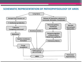 Comprehensive Overview of Acute Respiratory Distress Syndrome (ARDS ...