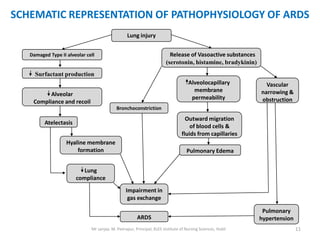 SCHEMATIC REPRESENTATION OF PATHOPHYSIOLOGY OF ARDS
                                                  Lung injury


   Damaged Type II alveolar cell                                          Release of Vasoactive substances
                                                                        (serotonin, histamine, bradykinin)
     Surfactant production
                                                                                    Alveolocapillary           Vascular
                                                                                      membrane               narrowing &
          Alveolar
                                                                                     permeability            obstruction
    Compliance and recoil
                                            Bronchoconstriction

                                                                                   Outward migration
         Atelectasis
                                                                                     of blood cells &
                                                                                 fluids from capillaries
                   Hyaline membrane
                       formation                                                   Pulmonary Edema


                          Lung
                       compliance
                                                 Impairment in
                                                  gas exchange

                                                                                                              Pulmonary
                                                       ARDS                                                  hypertension
                              Mr sanjay. M. Peerapur, Principal, KLES Institute of Nursing Sciences, Hubli                  11
 