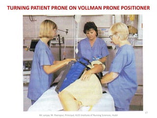 TURNING PATIENT PRONE ON VOLLMAN PRONE POSITIONER




                                                                                          17
           Mr sanjay. M. Peerapur, Principal, KLES Institute of Nursing Sciences, Hubli
 