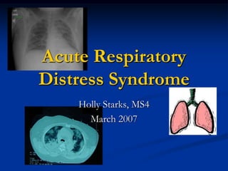 Acute Respiratory
Distress Syndrome
    Holly Starks, MS4
      March 2007
 